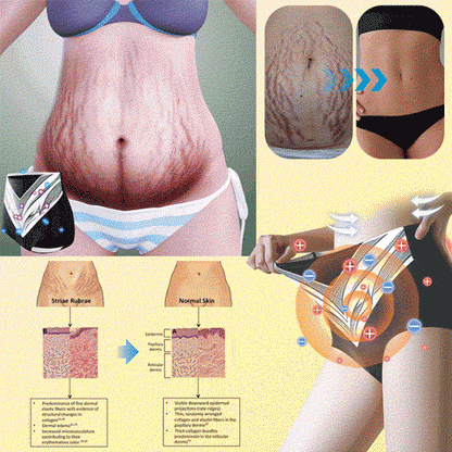 Mayo Clinic Official: Medical Grade Titanium Fiber Self-heating Tourmaline Shaping Shorts💌